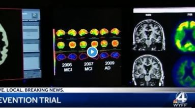 Research trial to help prevent Alzheimer's