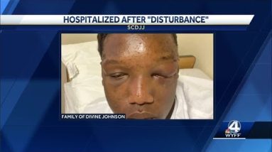 Teen hospitalized after attack while in DJJ custody, family demands answers