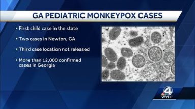 3 children in Georgia test positive for monkeypox, health officials say