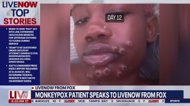Monkeypox patient contracted virus at Georgia gas station | LiveNOW from FOX