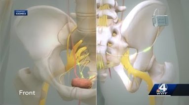 For Your Health: Bladder pacemaker eases urinary problems