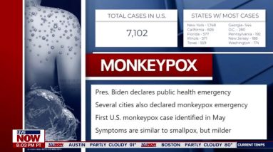 Russia-Ukraine updates, monkeypox vaccines and other top stories