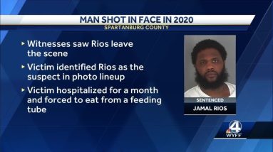 Hand gestures of man shot in face lead to arrest in shooting, officials say