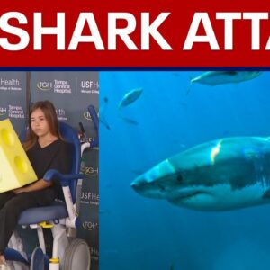 9-year-old bit by shark off Florida beach, has emergency surgery